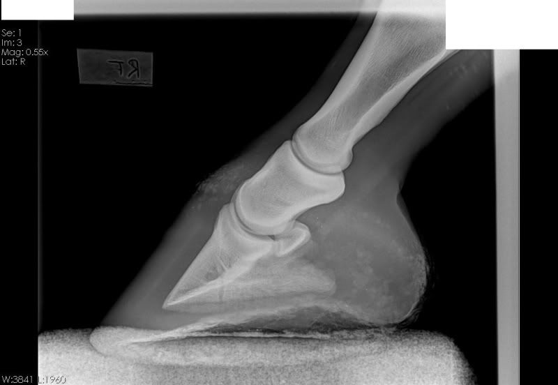 Pictures Negative rotation of pedal bone (x rays and before and after)