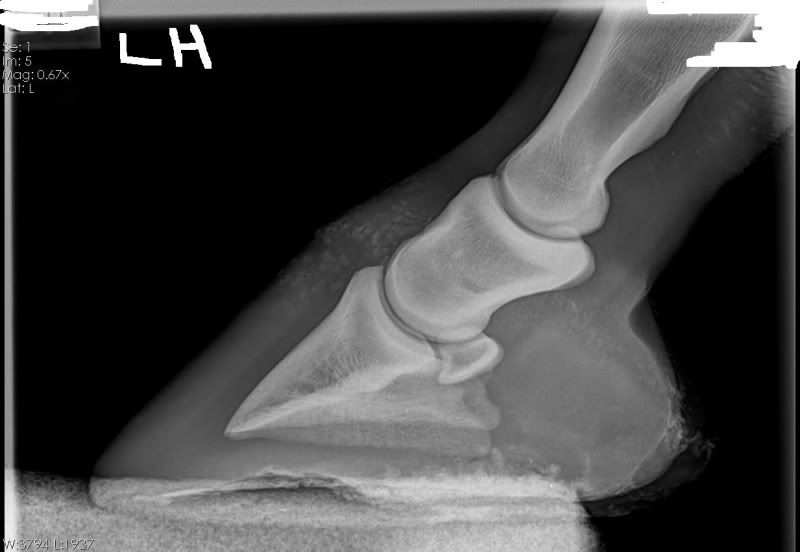 Pictures Negative rotation of pedal bone (x rays and before and after)