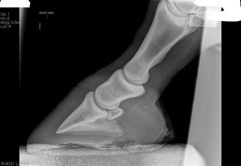 Pictures Negative rotation of pedal bone (x rays and before and after)