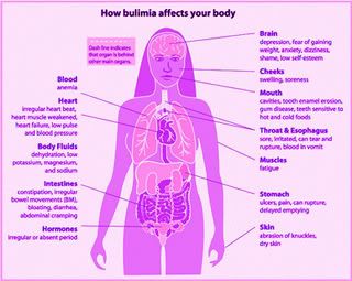 Laxative abuse Images