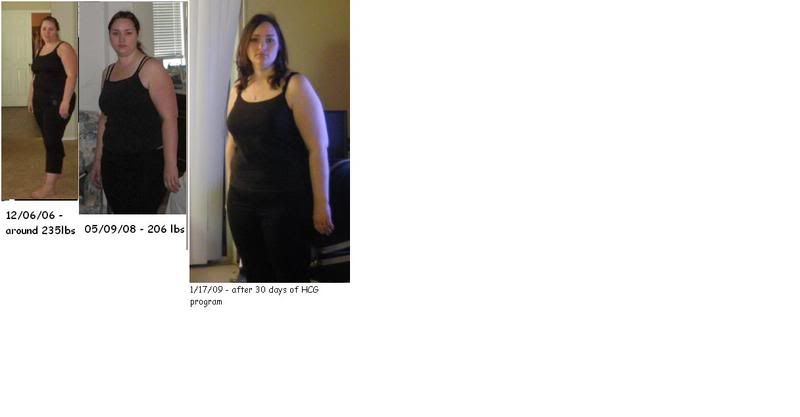 before and after hcg diet. efore HCG, then after I
