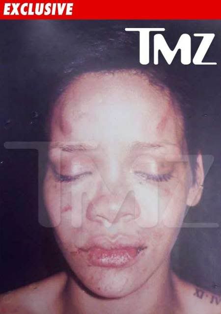 rihanna pictures after beating tmz. if Rihanna+face+eating